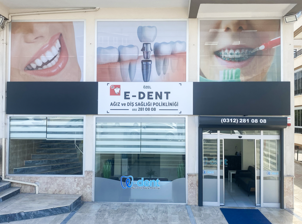 Eryaman'da Dişçi Tavsiyesi