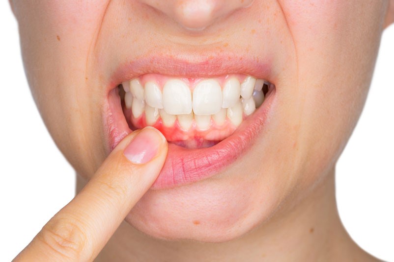 Periodontoloji Eryaman